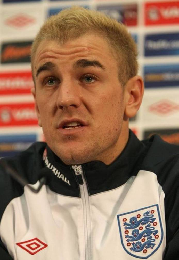 Joe Hart : pic #492136