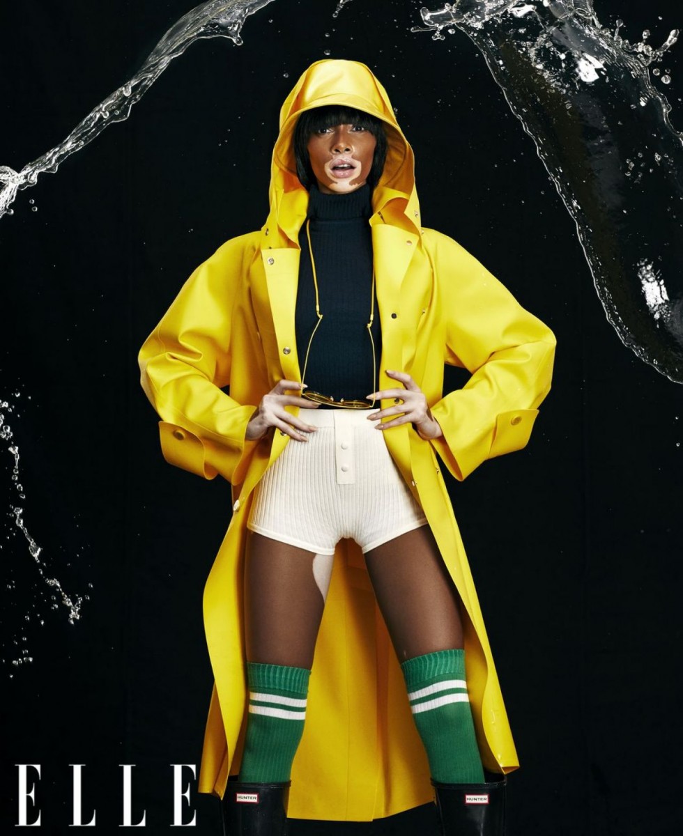 Winnie Harlow: pic #1106357