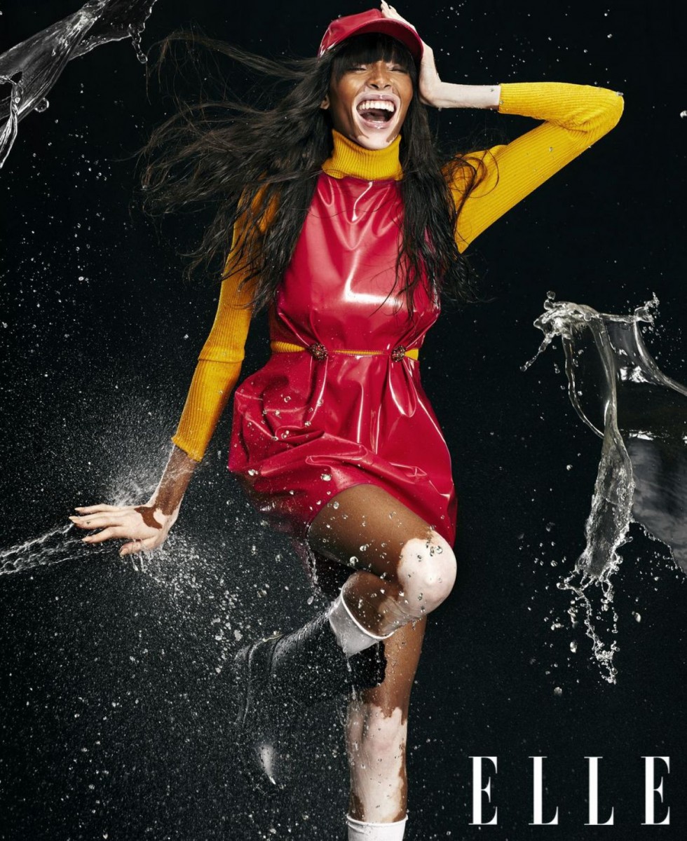 Winnie Harlow: pic #1106358