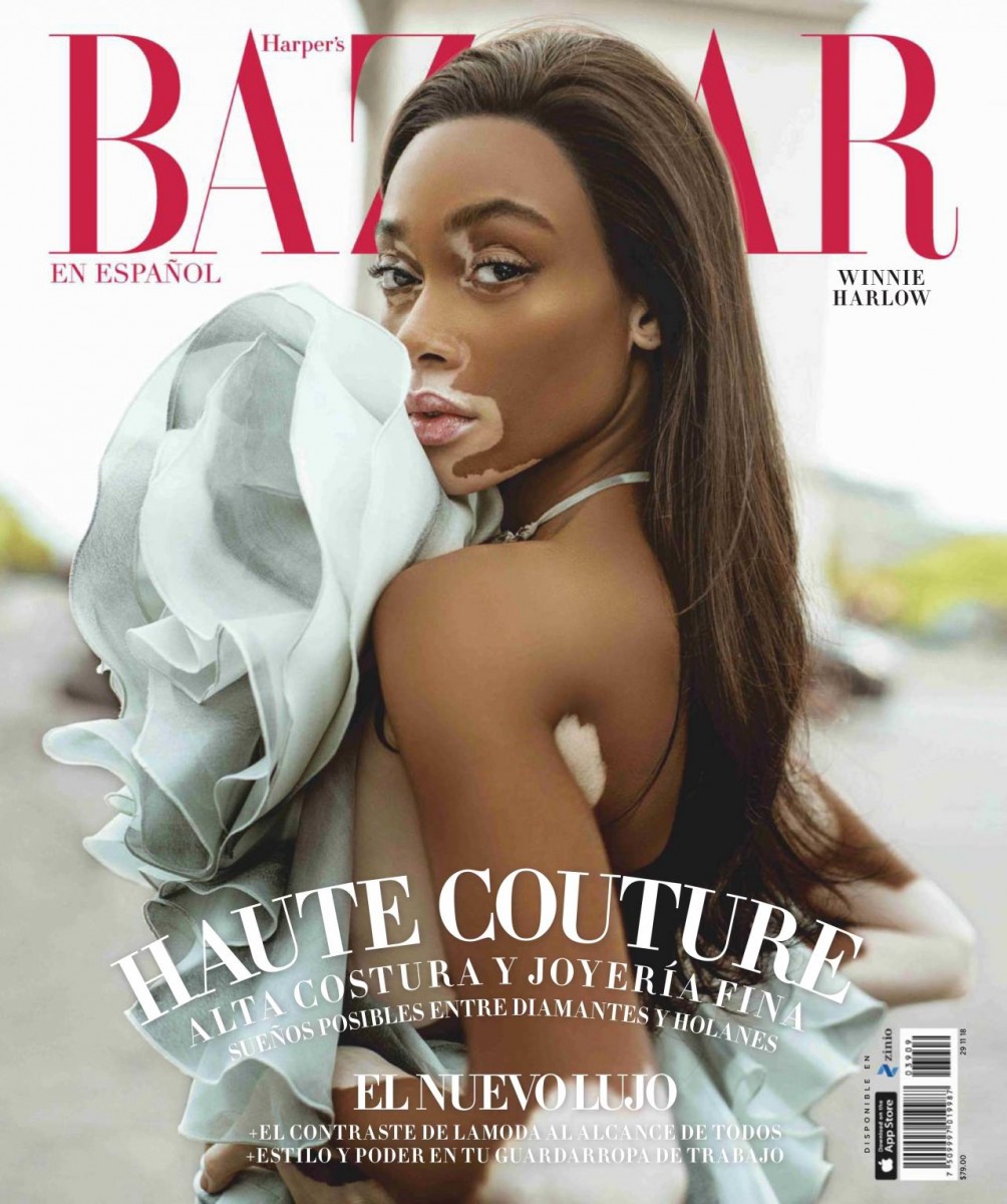 Winnie Harlow: pic #1079777