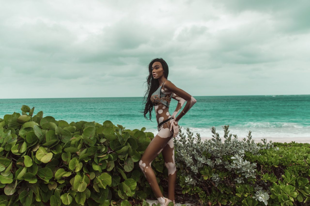 Winnie Harlow: pic #1118016