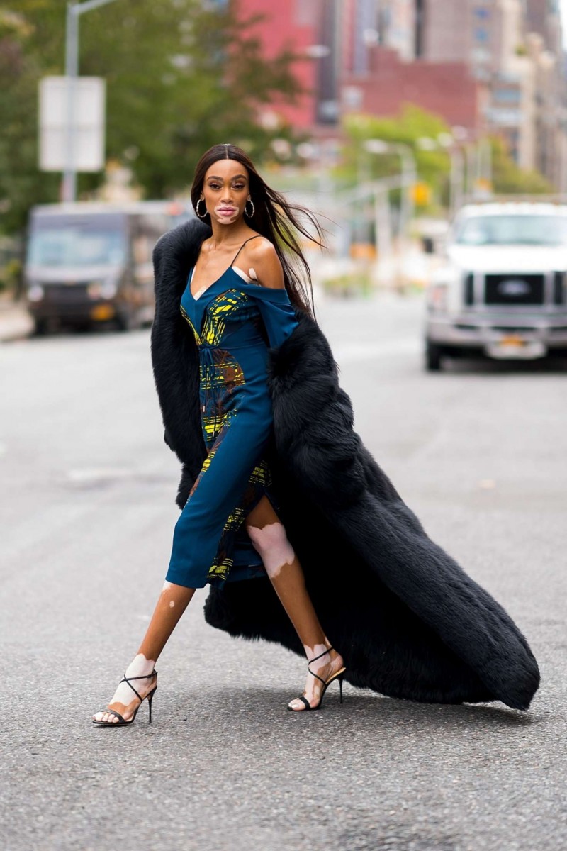 Winnie Harlow: pic #1078937