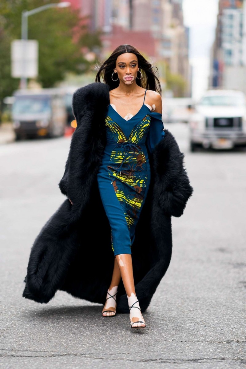 Winnie Harlow: pic #1078938