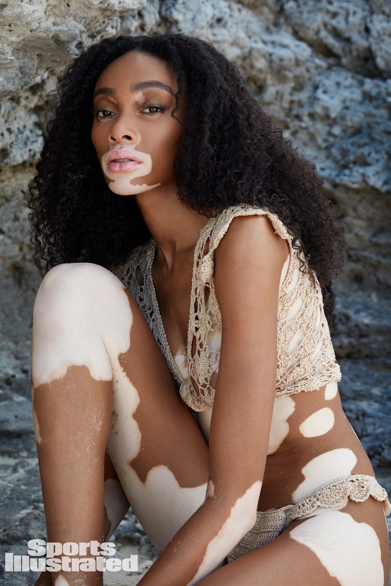 Winnie Harlow: pic #1147204