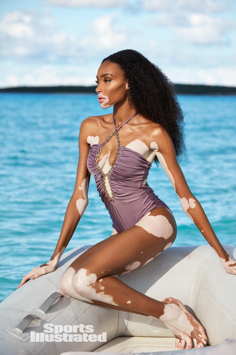 Winnie Harlow: pic #1147196