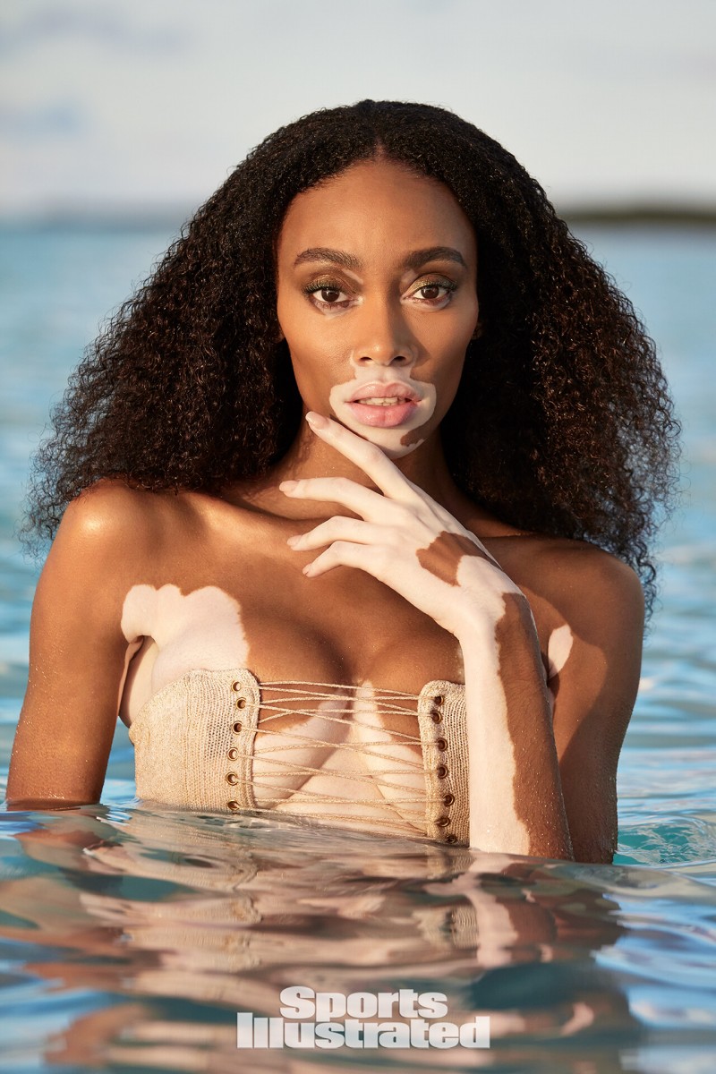 Winnie Harlow: pic #1147190