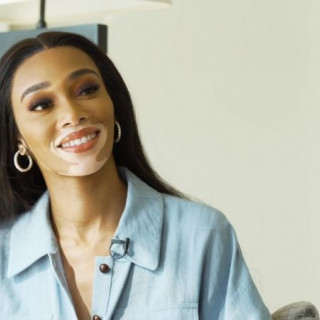 Winnie Harlow surprised with a hairstyle in the Bob Marley style 