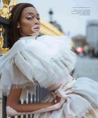 photo 6 in Winnie Harlow gallery [id1079778] 2018-11-05 00:00:00
