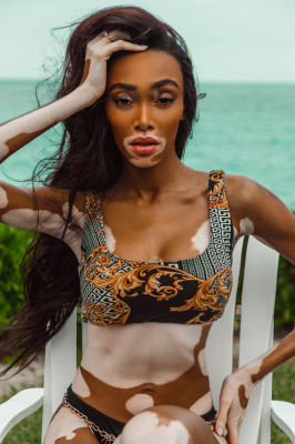 Winnie Harlow pic #1118011