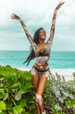 Winnie Harlow pic #1118012