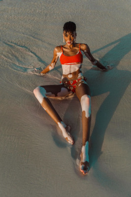 Winnie Harlow pic #1118010
