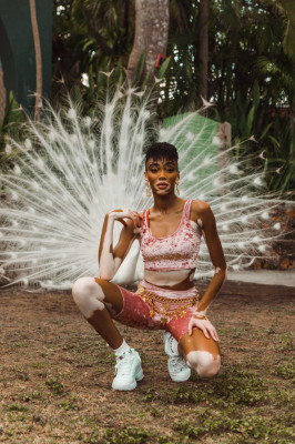 Winnie Harlow pic #1118009
