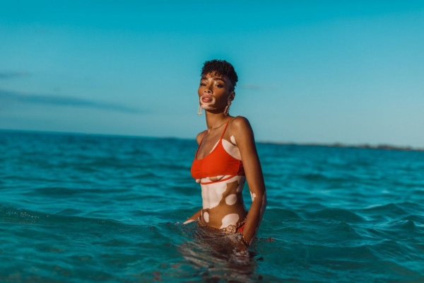 Winnie Harlow pic #1118013