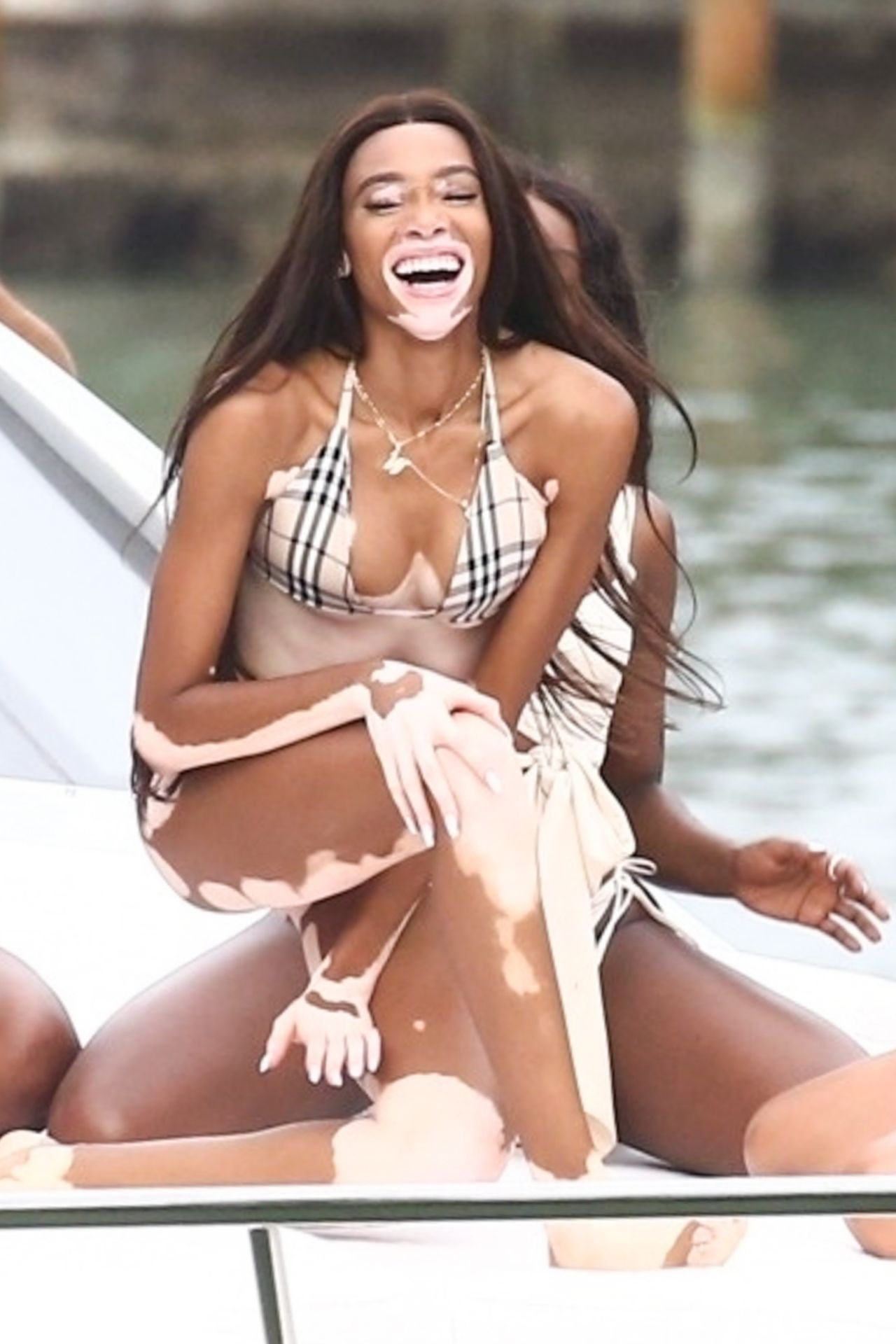 Winnie Harlow, photo #1055311