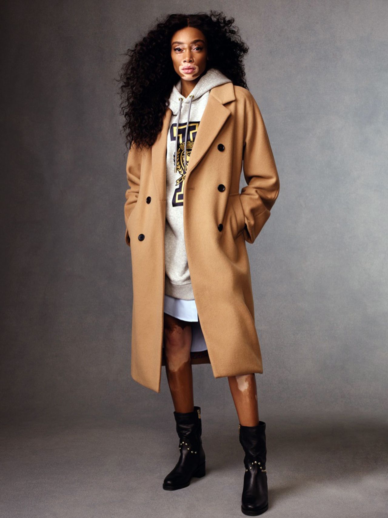 Winnie Harlow, photo #1061555